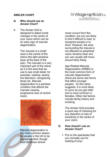 Grid Chart For Macular Degeneration