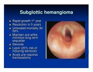 Subglottic hemangioma