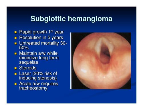 Subglottic hemangioma
