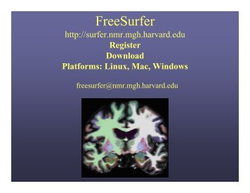 FreeSurfer