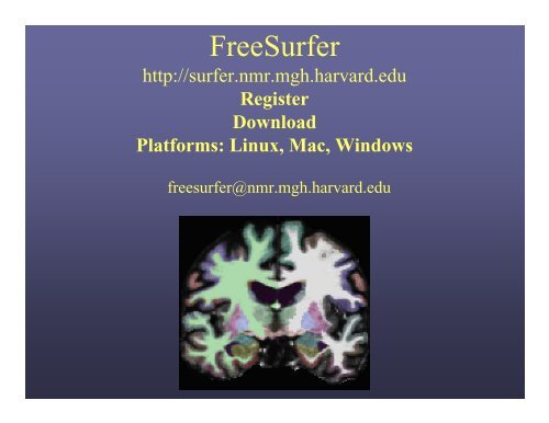 FreeSurfer