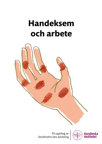 Handeksem och arbete