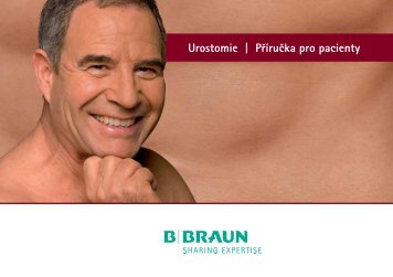 Urostomie | PÃ…â„¢ÃƒÂ­ruÃ„Âka pro pacienty -  Stomici.cz