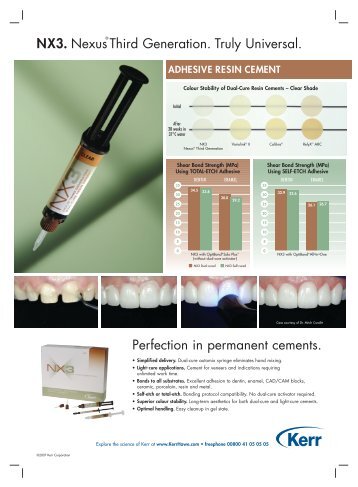 NX3. Nexus Third Generation. Truly Universal ... - CreativDental