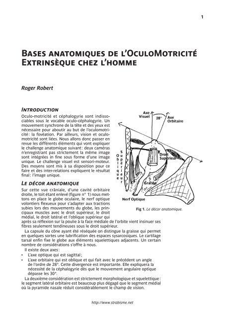 LE TORTICOLIS - Strabisme