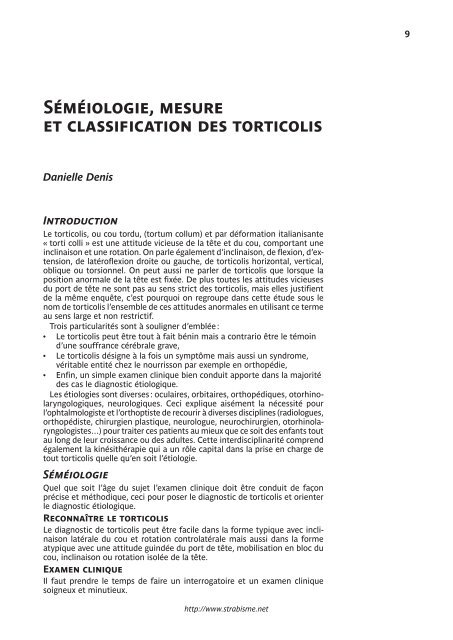 LE TORTICOLIS - Strabisme