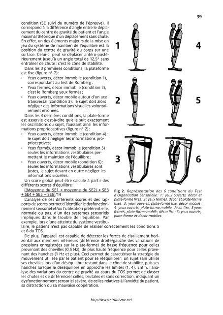 LE TORTICOLIS - Strabisme