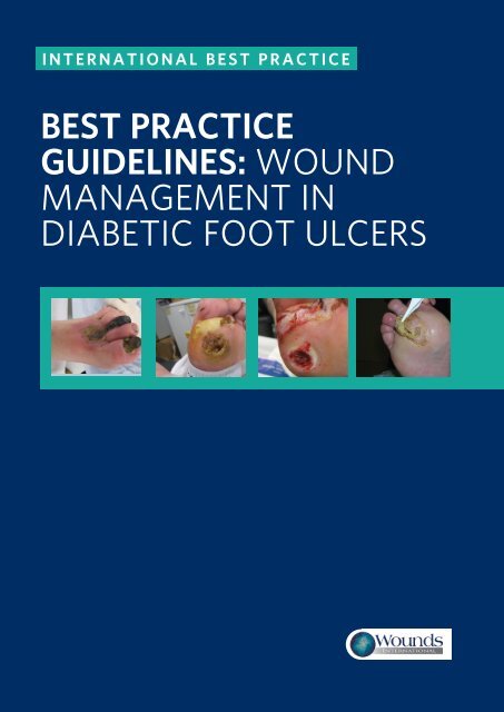 best practice guidelines: wound management in diabetic foot ulcers