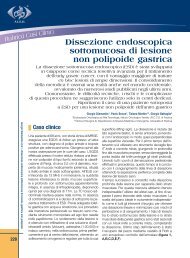 Dissezione endoscopica sottomucosa di lesione non polipoide ...