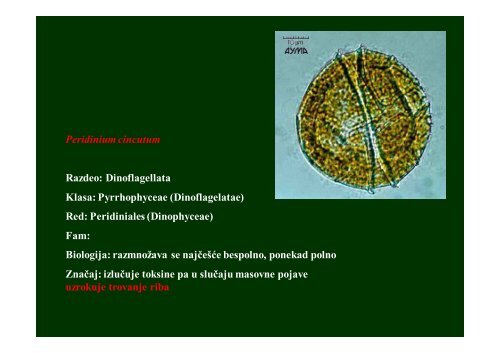 Protista (jednoćelijske alge, gljive i praživotinje) - Raka Web