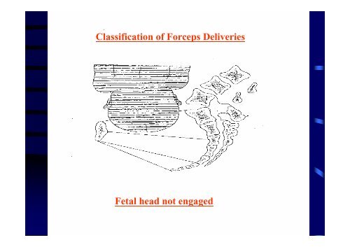 Survey on the Practice of Forceps Delivery in Public Hospitals in ...