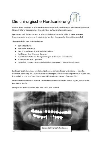 Systemische Entgiftung