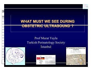 Murat Yayla_What must we see during obstetric ultrasound.ppt ...