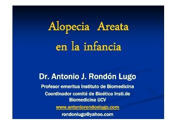 Alopecia areata derm Pediatrica - Antonio RondÃ³n Lugo