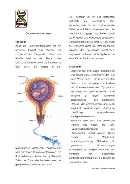 Chorionzottenbiopsie - Maiwald, Dr. Robert Maiwald