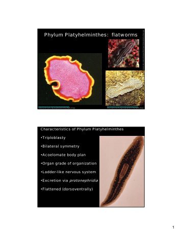 Phylum Platyhelminthes: flatworms