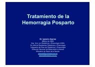 Tratamiento de la Hemorragia Posparto - IGBA