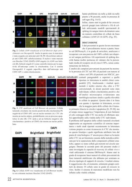 Un nuovo approccio per lo studio delle cellule tumorali ... - Enea