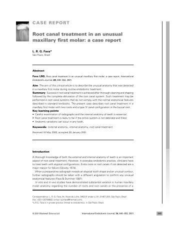 Root canal treatment in an unusual maxillary first molar: a case report