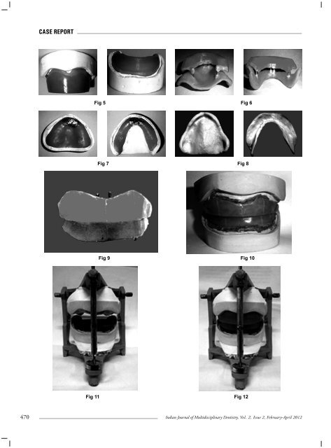 Volume 2 - Issue 2 - IJMD