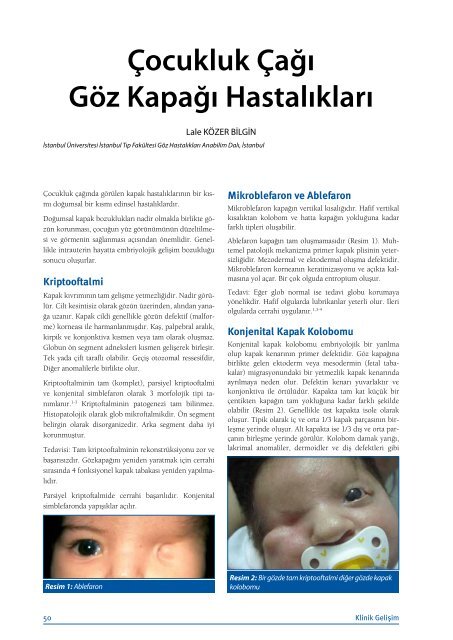 Ãocukluk ÃaÄÄ± GÃ¶z KapaÄÄ± HastalÄ±klarÄ± - Klinik GeliÅim