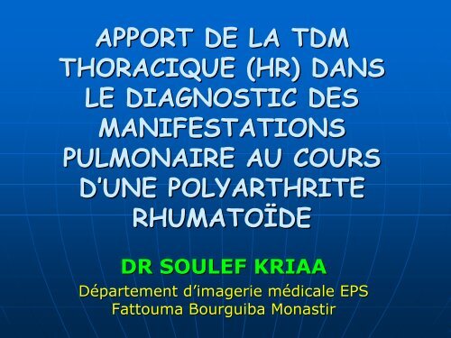 APPORT DE LA TDM THORACIQUE (HR) DANS LE DIAGNOSTIC ...