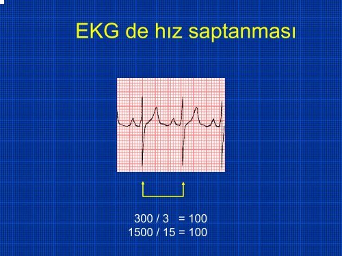 TEMEL EKG