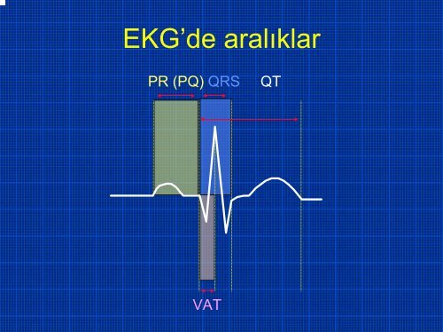 TEMEL EKG