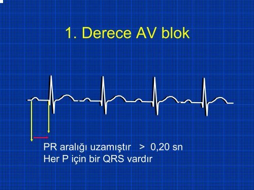 TEMEL EKG