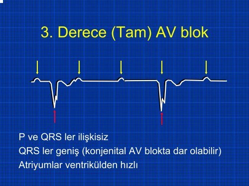 TEMEL EKG