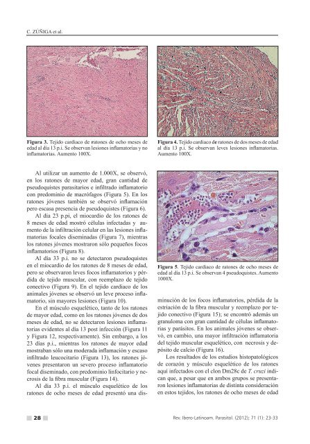 (Eh) y metanÃ³lico (Em) de Pera distichophylla sobre un aislado de ...