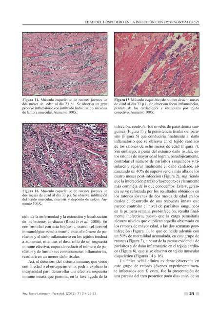 (Eh) y metanÃ³lico (Em) de Pera distichophylla sobre un aislado de ...