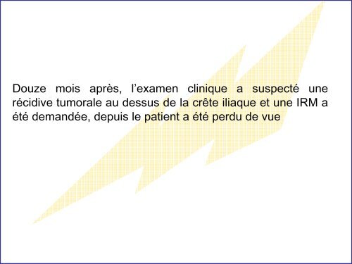 Apport de l'IRM dans le diagnostic des tumeurs desmoÃ¯des extra ...