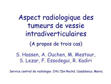Aspect radiologique des tumeurs de vessie intradiverticulaires