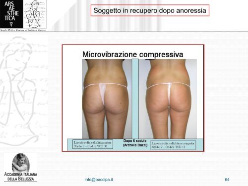 Microvibrazione compressiva