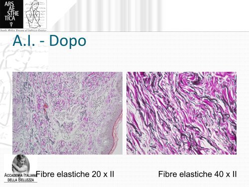 Microvibrazione compressiva