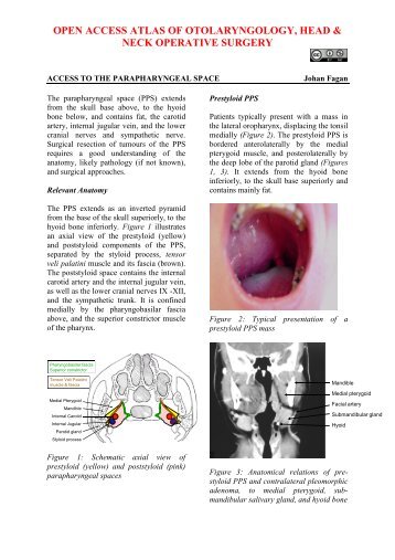 Access to Parapharyngeal Space - Vula - University of Cape Town