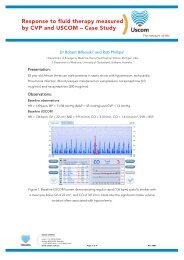 Fluid Responsiveness In Irregular Cardiac Rhythms - Uscom