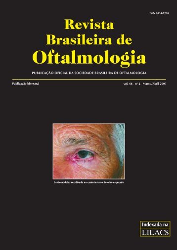 Mar-Abr - Sociedade Brasileira de Oftalmologia