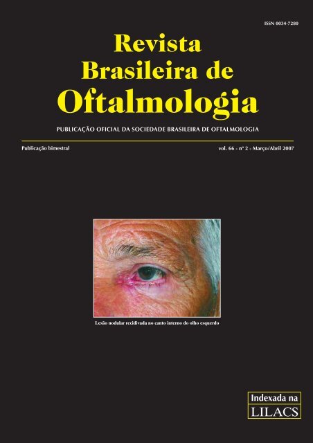 Mar-Abr - Sociedade Brasileira de Oftalmologia