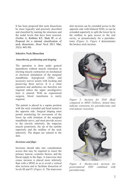 Selective Neck Dissection - Vula - University of Cape Town