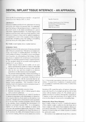 dental implant tissue interface - EJUM - University of Malaya