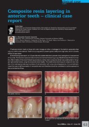 Composite resin layering in - FGM-Dental: Startseite