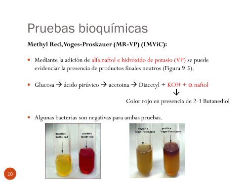 IdentificaciÃ³n bioquÃ­mica de los bacilos Gram-negativos CapÃ­tulo 9