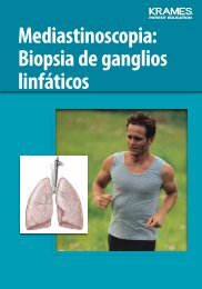 Mediastinoscopia: Biopsia de ganglios linfáticos - Veterans Health ...