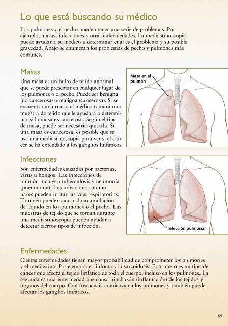 liquido en los pulmones gravedad