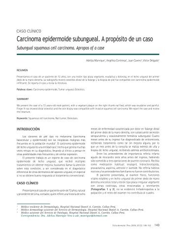 Carcinoma epidermoide subungueal. A propÃ³sito de un caso