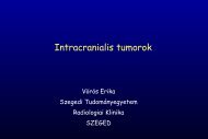 Intracranialis tumorok - Szegedi TudomÃ¡nyegyetem