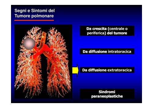 (Microsoft PowerPoint - CANCRO DEL POLMONE 1 LEZIONE 2010 ...