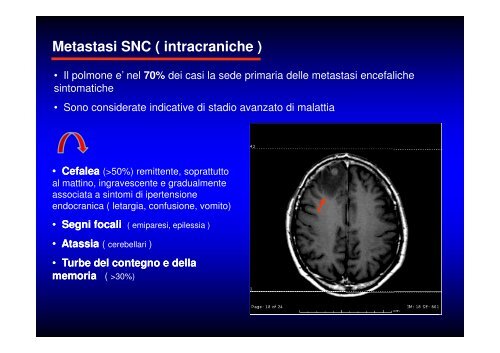 (Microsoft PowerPoint - CANCRO DEL POLMONE 1 LEZIONE 2010 ...